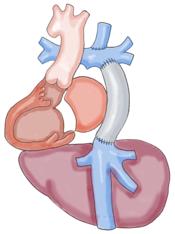 心脏和肝脏疾病-方丹生理学